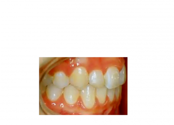 【第１６回】各都市の動画配信への反響